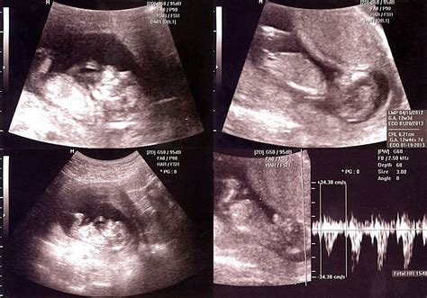 Our Little Hill: Hey Baby!: 12 Week Ultrasound