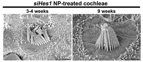 Cochlea Hair Cells