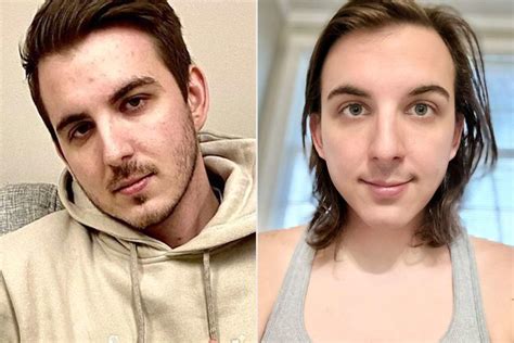 MrBeast YouTube Star Chris Tyson Shows Off Transformation After Starting Hormone Replacement Therapy