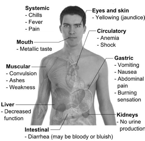 Main symptoms of copper poisoning (by Mikael Häggström) . | Download ...