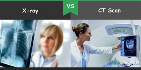 Difference Between X-ray and CT Scan – Bio Differences