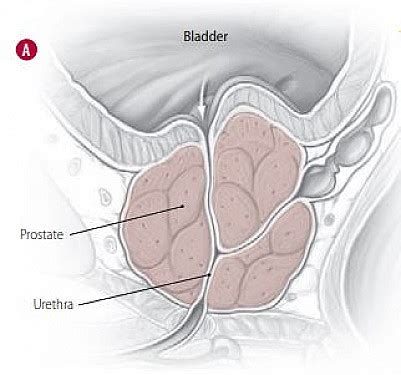 How Long Does Oxybutynin Stay In Your System : How long does oxybutynin ...