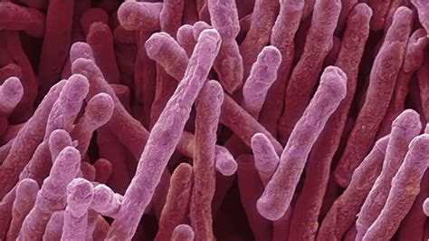 Mycobacterium smegmatis as Vaccine-vectors - Creative Biolabs