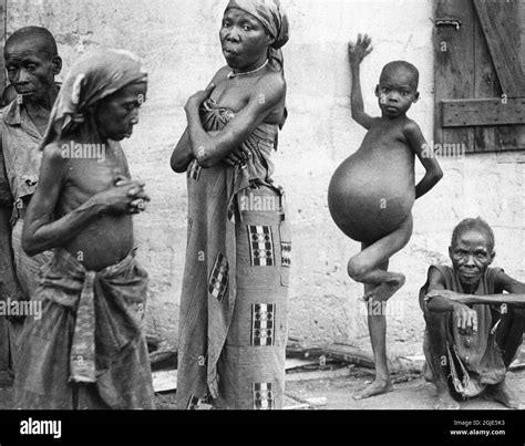 Child biafran war Black and White Stock Photos & Images - Alamy