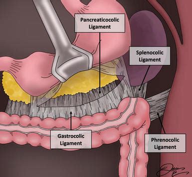 Splenic Flexure Mobilization Series | Danielle Eble