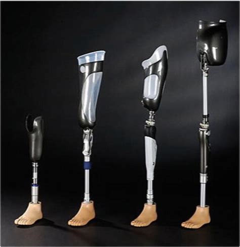 Prosthetics for Lower Limb Amputation | IntechOpen