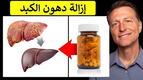 أفضل فيتامين على الإطلاق لإزالة وتطهير دهون الكبد - دكتور بيرج - YouTube