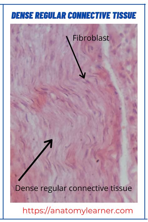 Dense regular connective tissue histology slide picture | Histology slides, Gross anatomy, Anatomy