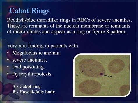 Practical Hematology Lab - ppt download