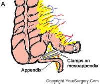 【mesoappendix】什么意思_英语mesoappendix的翻译_音标_读音_用法_例句_在线翻译_有道词典