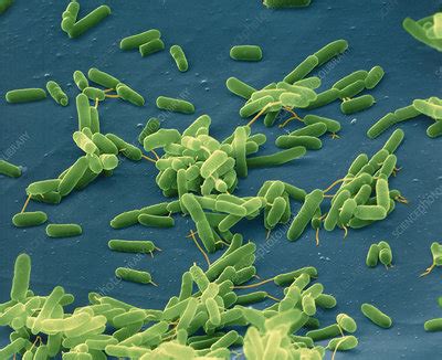 Pseudomonas aeruginosa bacteria - Stock Image - B220/1004 - Science Photo Library