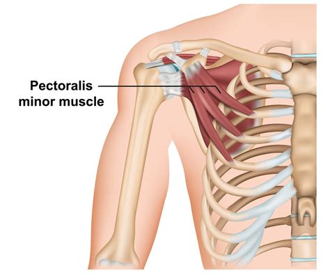 Pectoralis Minor Muscle: Anatomy, Function, and Treatment