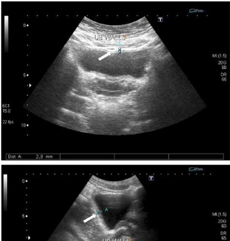 Bladder Ultrasound | Urologist in Forest Hills, Queens, NY | Medex - Multi-Specialty Medical Center