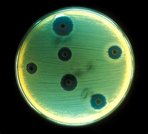 Free picture: aerobic, bacteria, staphylococcus, aureus, cultured, agar, plate, drug ...