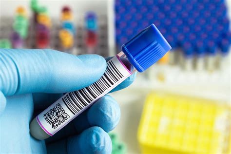 3 Essentials for Setting Up COVID-19 Serology Testing in the Lab | COVID-19 Briefings