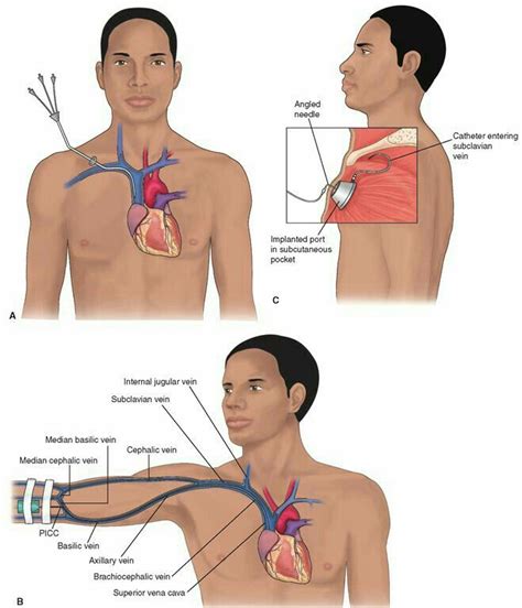 Nursing Iv, Cardiac Nursing, Nursing Study, Nursing Notes, Nursing Care, Nursing Assessment ...