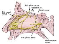 Nasopalatine Nerve Block