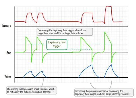 end tidal co2 waveforms - Rolande Kaplan