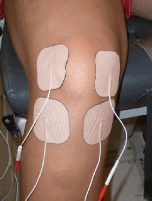 Case Study: Quadriceps Inhibition and TENS Post Knee Surgery - The ...