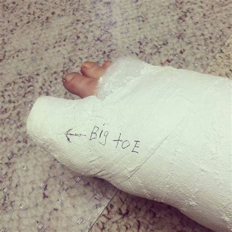 castgirls: webfinds: broken toe casts