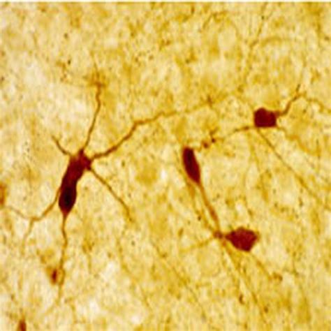 Neuropeptide Y Antibody | Immunostar