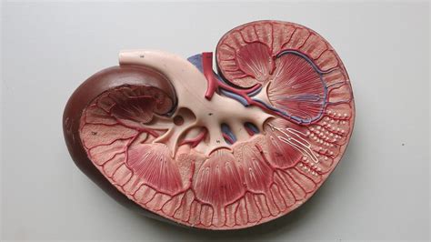 Ardelyx reports positive data from tenapanor’s Phase III CKD trial