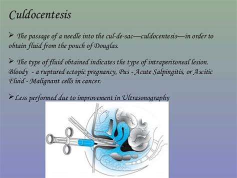 Medical investigations in gynecological patients