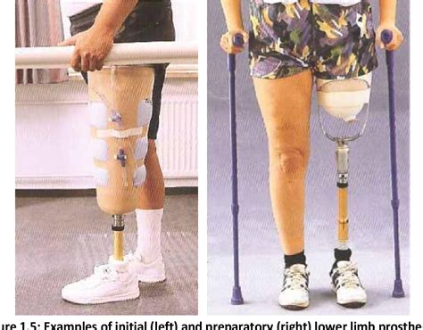 [PDF] Knowledge-based design of lower limb prosthesis | Semantic Scholar