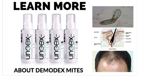 Blog | Demodex Treatment - Human Hair Follicle Mites: Demodex Mites Symptoms