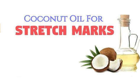 Coconut Oil For Stretch Marks (16 Remedies That Work)