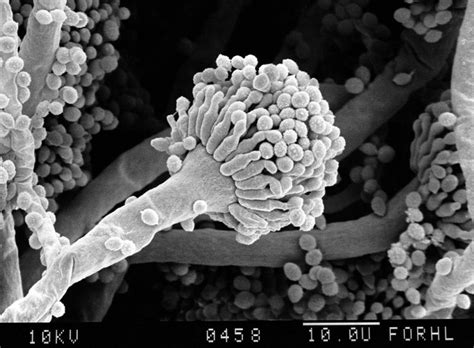 Aspergillus fumigatus, conidia, close-up SEM | Wellcome Collection