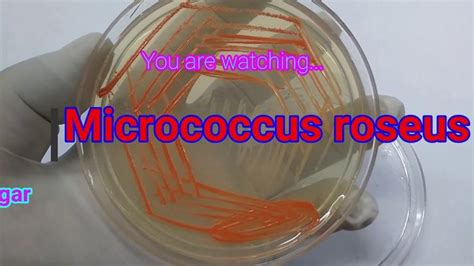 Micrococcus Roseus - Canthaxanthin | A Listly List