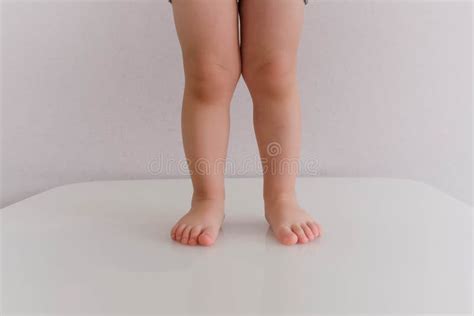 Low Section of Baby Boy Standing. 2 Years Old Flat Feet in a Child, the ...