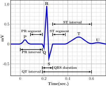 PQRST complexes in the ECG waveform | Download Scientific Diagram