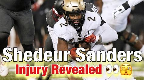 Buffs Forever: Breaking News Shedeur Sanders Injury Has Been Revealed ...