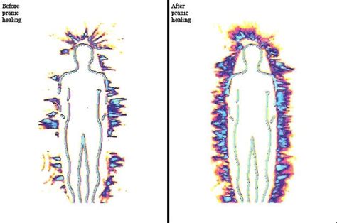 Aura before and after