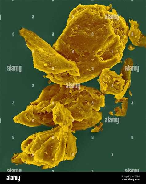 Coloured scanning electron micrograph (SEM) of Xanthan gum ...