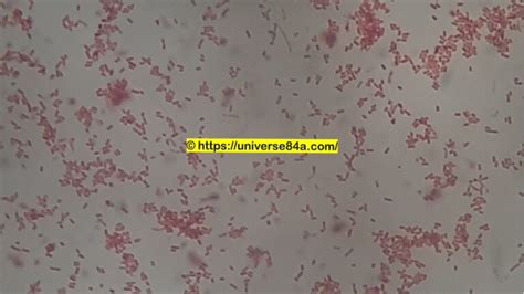 Shigella sonnei: Introduction, Morphology, Pathogenicity, Lab Diagnosis