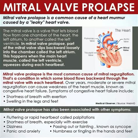 Mitral Valve Prolapse … | Mitral valve prolapse, Nursing school life ...