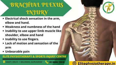 Brachial Plexus Injury Symptoms