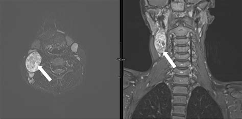 Cureus | Multimodal Imaging Characteristics and Diagnostic Approach to ...