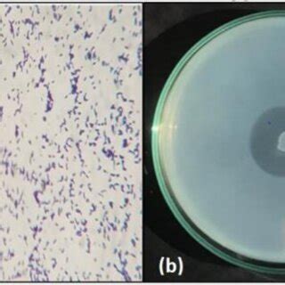 (a) Result of gram staining under light microscope with magnification... | Download Scientific ...