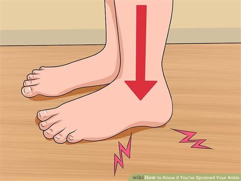 How to Know if You've Sprained Your Ankle (with Pictures)