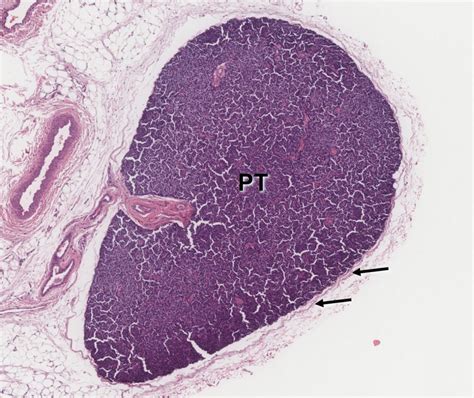 Parathyroid glands – Veterinary Histology