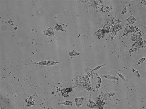 Anybody know about the black dots present between the HepG2 cell lines? Is this cell debris or ...