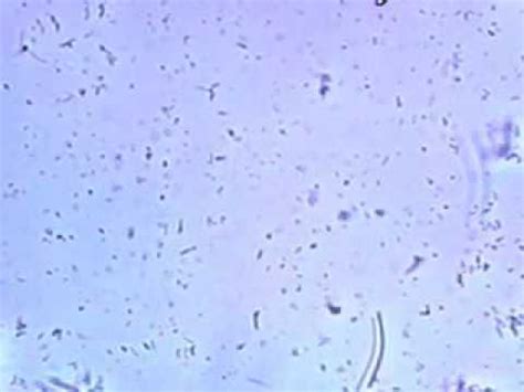 Live Bacteria - YouTube