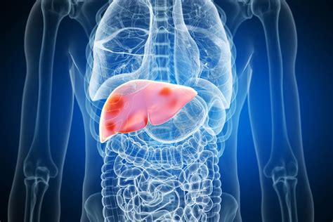 Can ChatGPT Help Adults Manage Their Liver Disease? - JASON LEE