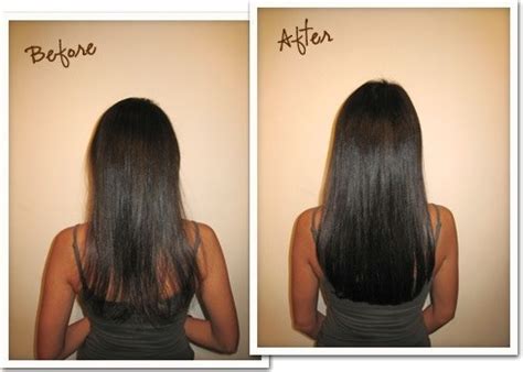 Before and After Nioxin - Nioxin Shampoo Review | Hold the Hairline