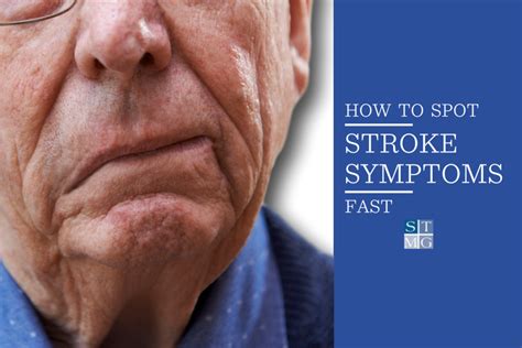 Spot Stroke Symptoms FAST With These Guidelines | STMG Nashville