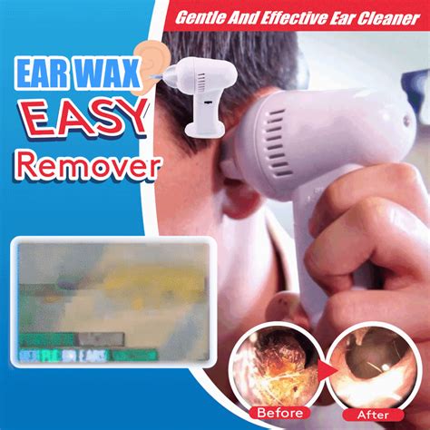 Ear Wax Easy Remover | Ear wax, Ear cleaning wax, Full face mask